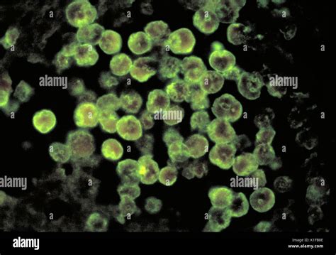  Naegleria: ¡Una ameba con un apetito voraz que puede habitar en aguas cálidas y turbias!