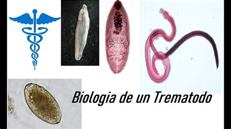  Tremátodos: ¿Conoces la Fascinante Historia del Tremátodo Tapeworm?