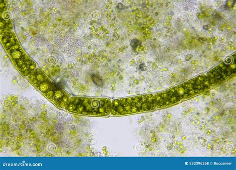   Yellow-green Algae: Unlocking the Secrets of a Microscopic Powerhouse with Undulating Flagella!